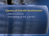 Erectile Dysfunction Basics : What are the primary causes of erectile dysfunction?