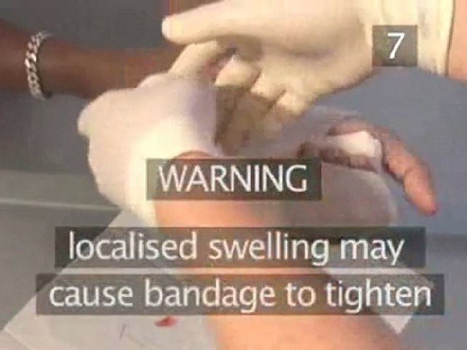 How To Help Control Bleeding From A Hand Cut