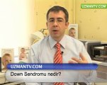 bebeklerde.net - down sendromu nedir?