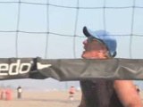 The Beach Volleyball Set : How is the 'set' in beach volleyball executed?