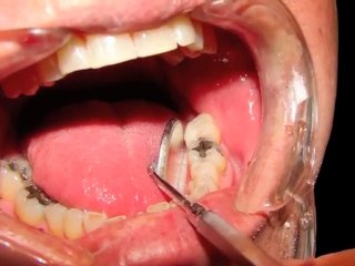 Family and Cosmetic Dentists | Seycove Dental