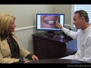 Veneers & Crowns Patient of Dr. Goldin in Clawson & Troy MI