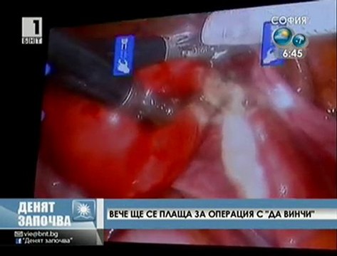 Вече ще се плаща за операция с Да Винчи