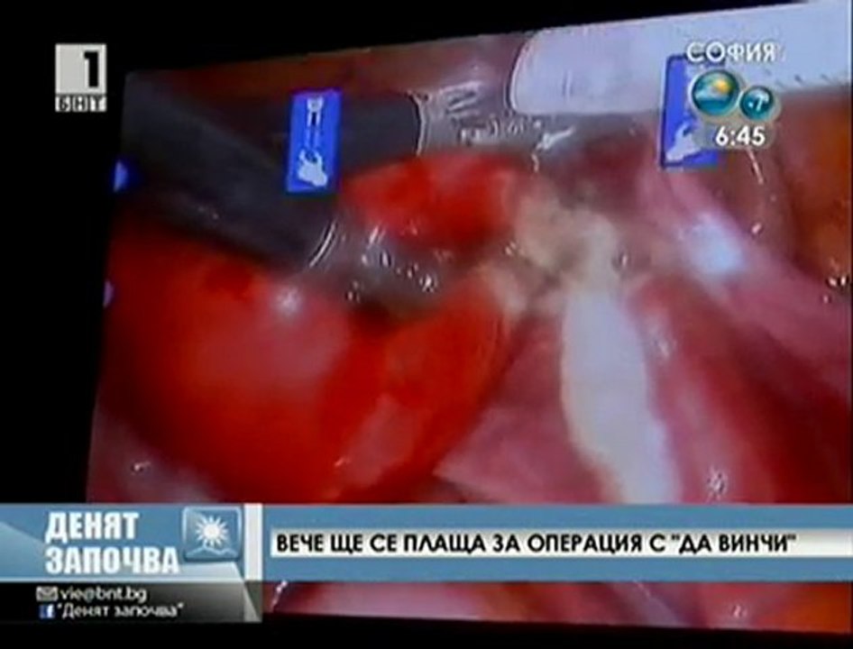 Вече ще се плаща за операция с Да Винчи