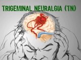 Living With Trigeminal Neuralgia?  Trigeminal Neuralgia ...