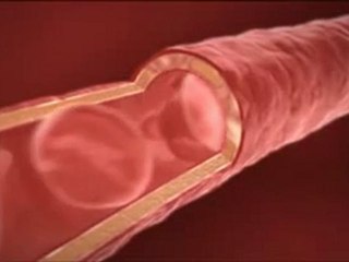 Les bienfaits du gel pur d'Aloe Vera