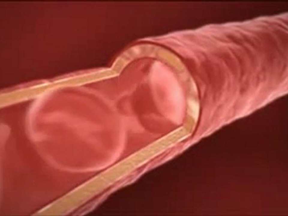 Les bienfaits du gel pur d'Aloe Vera