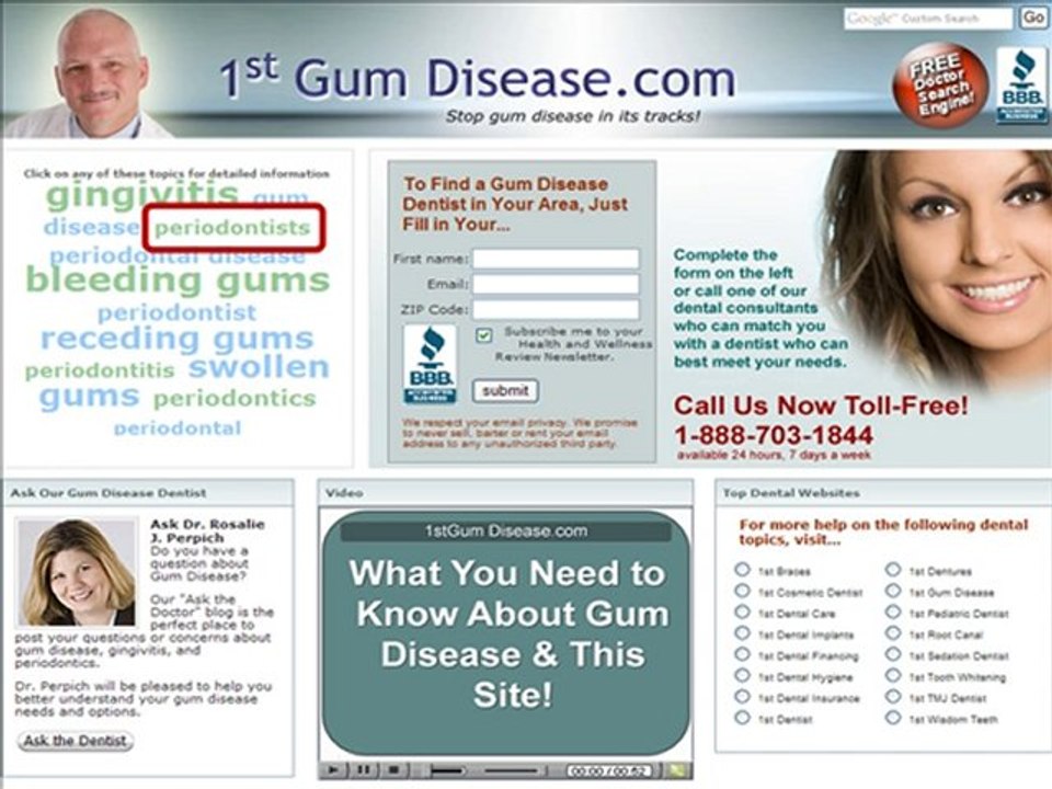 Gingivitis Price for Quality Dental Work