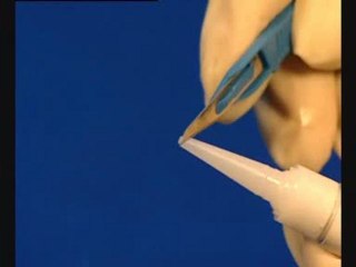 Colla per ferite, adesivo per suture