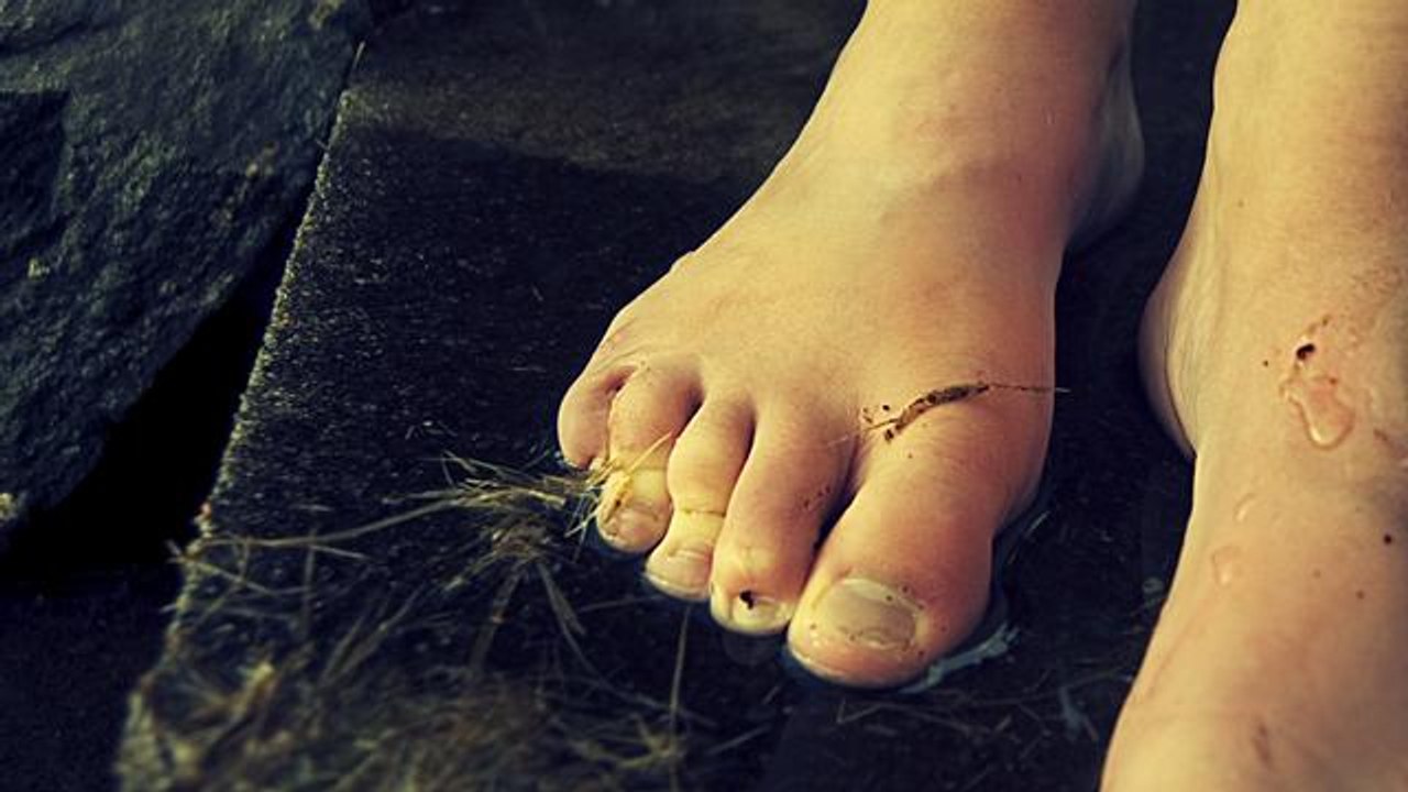 How To Understand Foot Ulcer Treatment
