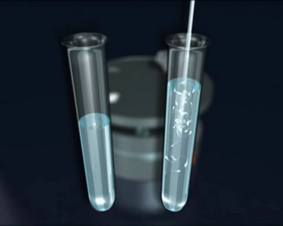 Aşılama için sperm hazırlama