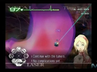 Trauma Center: Second Opinion Walkthrough - Episode ...