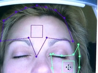 СпБ: Скидка 55% на компьютерную диагностику кожи лица