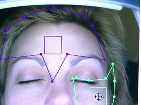 СпБ: Скидка 55% на компьютерную диагностику кожи лица