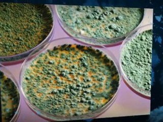 Getting Rid of Mold Anchorage