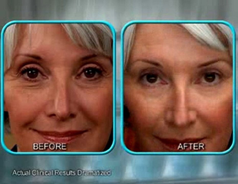 Stem Cell Therapy Cream