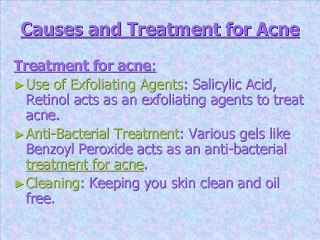 Causes and Treatment for Acne