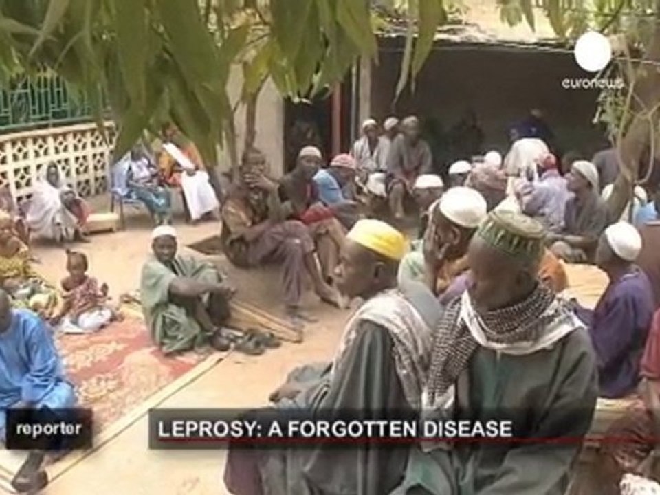 La lebbra, un morbo contro cui si continua a lottare