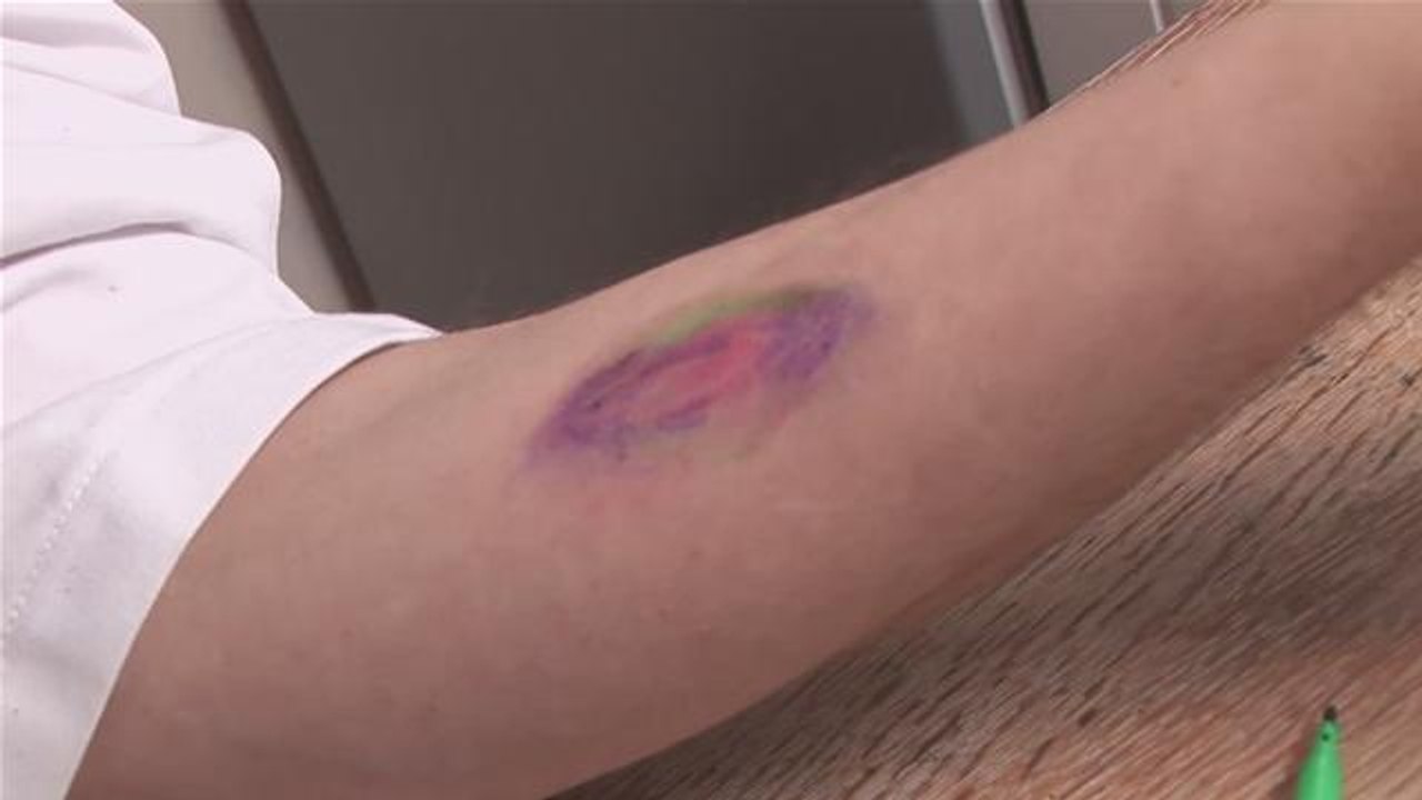 How To Make Fake Bruises Without Using Makeup