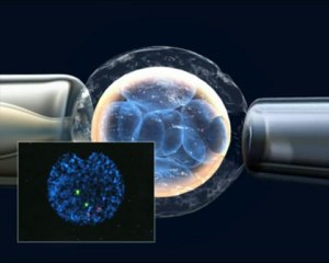 Preimplantasyon genetik tanı