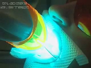 Cheap Fast Teeth Whitening