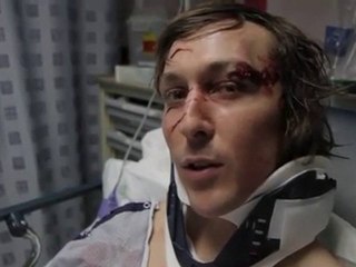 Crash - Verde BMX - Brian Yeagle speaks on cracking his skull