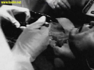 Roswell Alien Autopsy - Roswell Uzaylı Otopsi