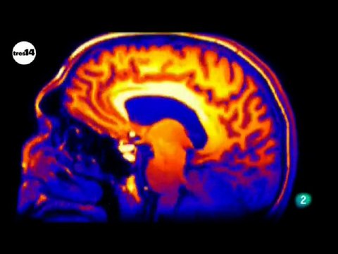 Diagnostico por imagen: Curiosidades cientificas