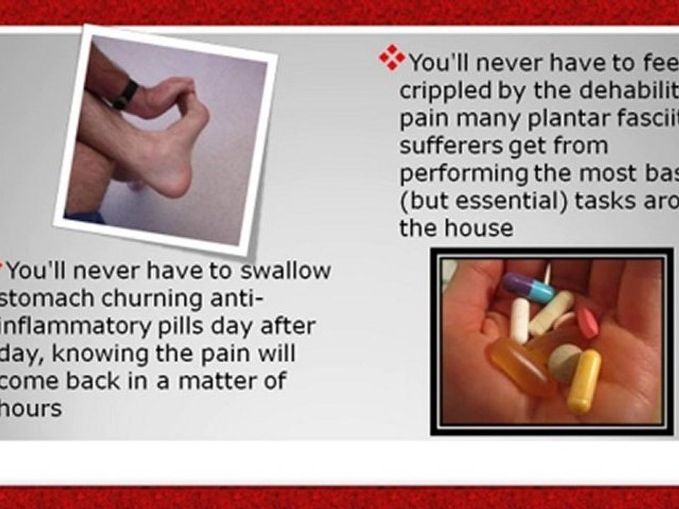 Plantar Fasciitis Treatment At Home - Exercises for Plantar