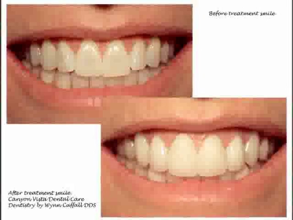 Don't Wait To Find A Dentist Until You Need One