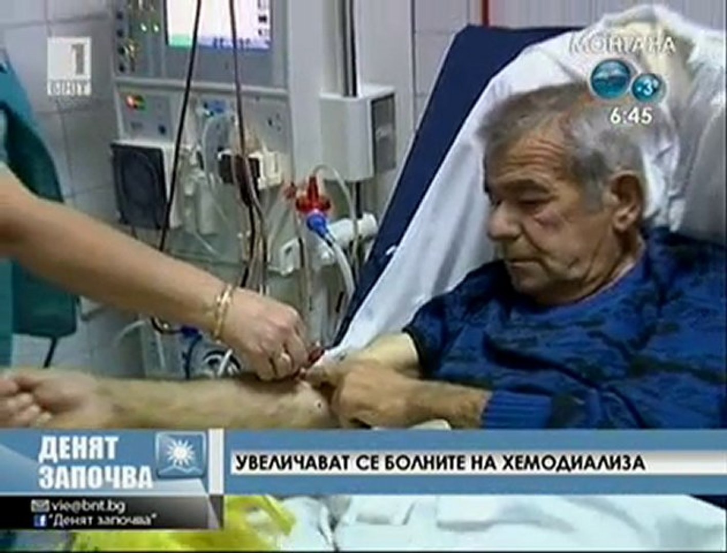 ⁣Увеличават се болните на хемодиализа