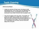 Edinburgh Dentist on Teeth Cleaning