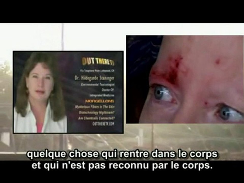 Chemtrails, Nano et MORgellons part1 A VOIR ABSOLUMENT
