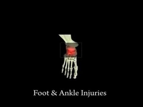 Foot Pain and Ankle Sprains - Family Foot and Leg Center / Naples Podiatrist