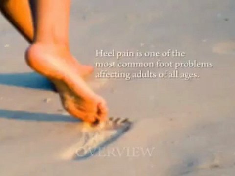 Heel Pain - Family Foot and Leg Center / Naples Podiatrist