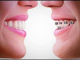Vancouver Dentists - Kingsgate Dental