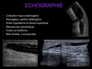 Une glissade à moto