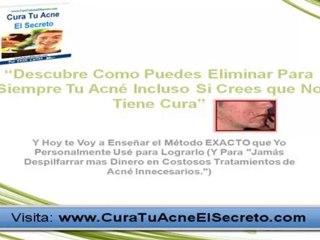 Tratamiento Para el Acne (Reporte GRATIS)