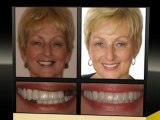 Family Dentistry Dental Implants Dentist Wakefield IN