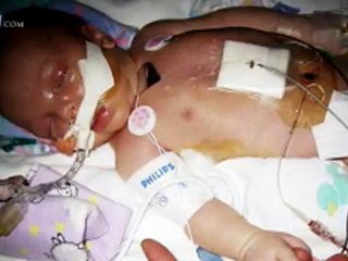 Patrick Shugart: Fighting to Live - CBN.com