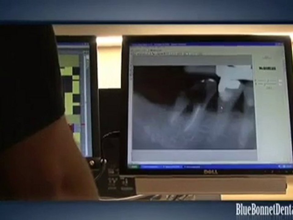 Mandeville Dentist LA   985-626-5030    ‎