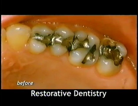 Minneapolis Dentist MN (952) 891-8484