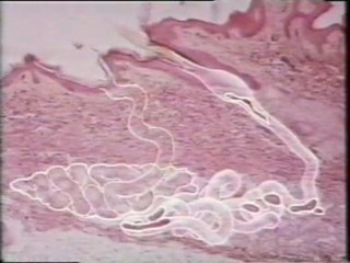 El sudor: Glandulas sudoriparas