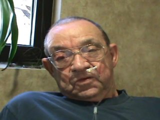 COPD Patient Treated with Stem Cells