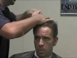 End Hair protez saç uygulama video