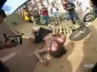 FACEPLANT! Knocked Out Cold