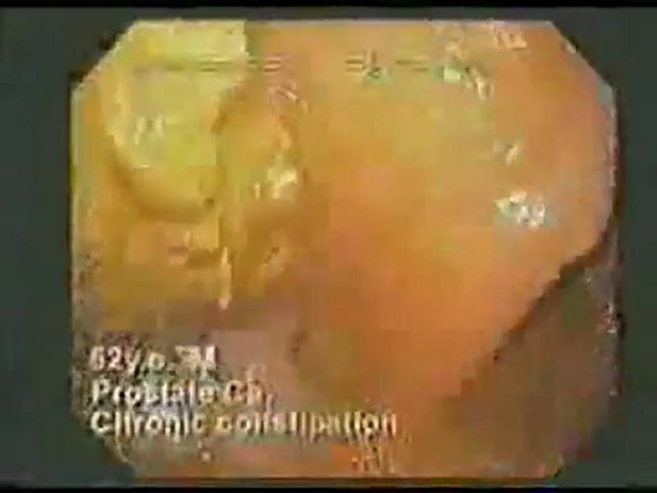 3-drshinya-darmspiegelungen