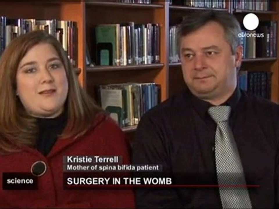 Pre-birth spina bifida breakthrough.