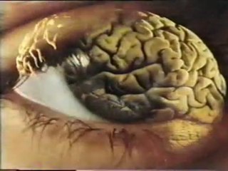 Trastornos cerebrales