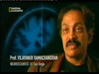 BIID: Trastorno de identidad de la integridad corporal